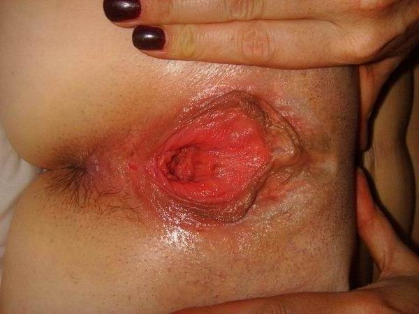 12P extreme gaping twats and assholes