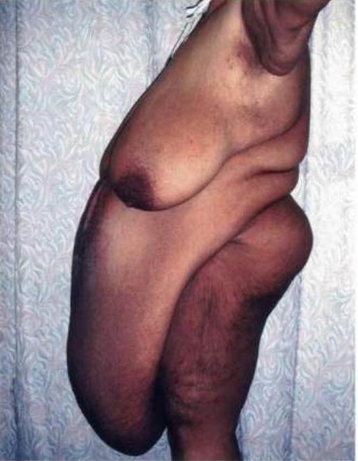 16P Super sized ladies