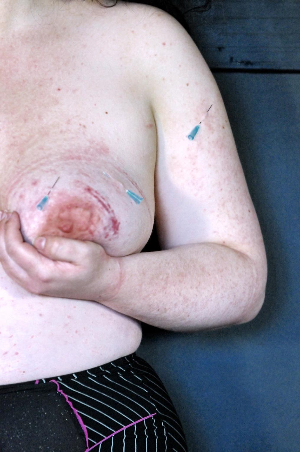 16P Extreme needle torture of bbw painslut RosieB in destroyed tit punishments