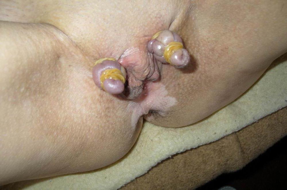 18P Pussy lips extreme bondage
