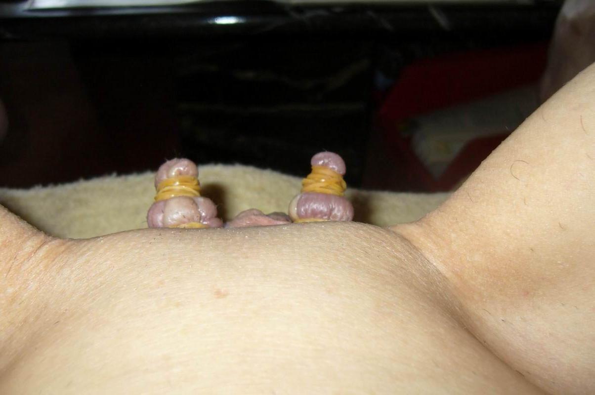 18P Pussy lips extreme bondage
