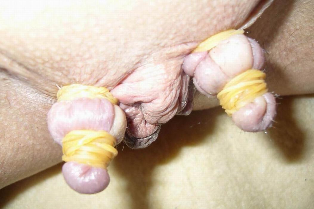 18P Pussy lips extreme bondage