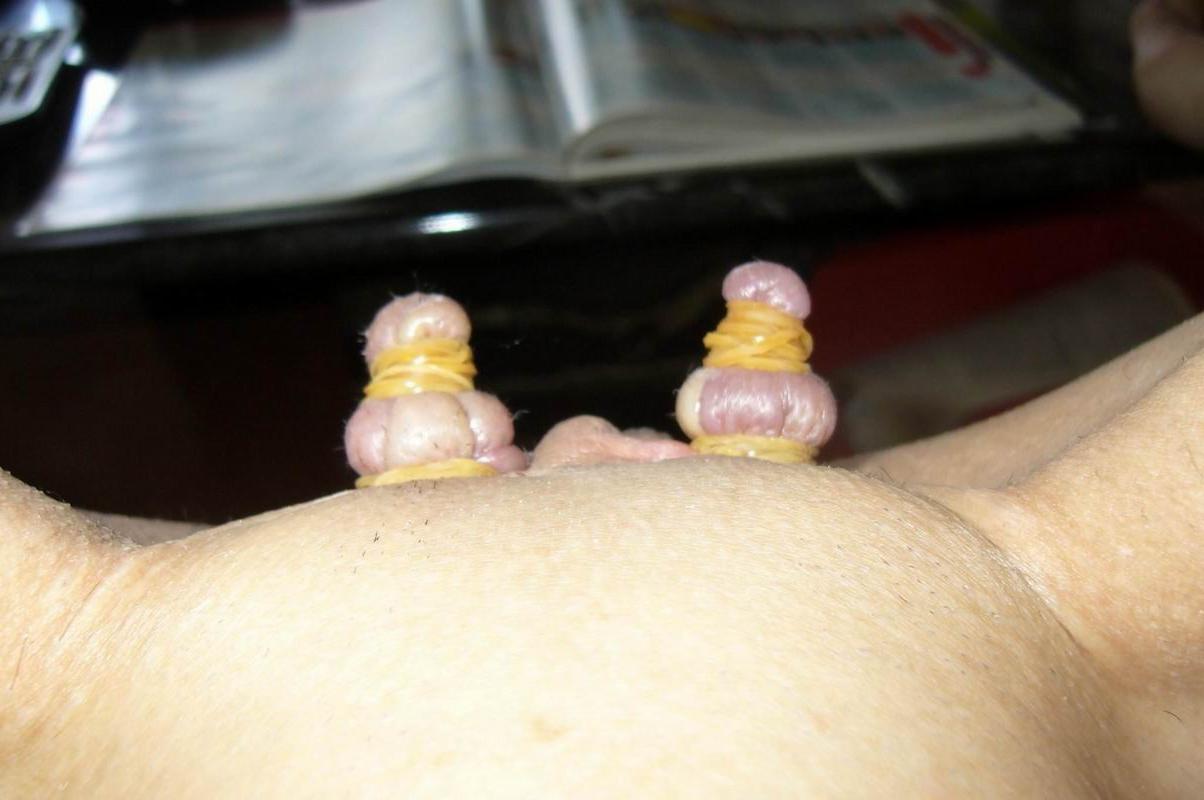 18P Pussy lips extreme bondage