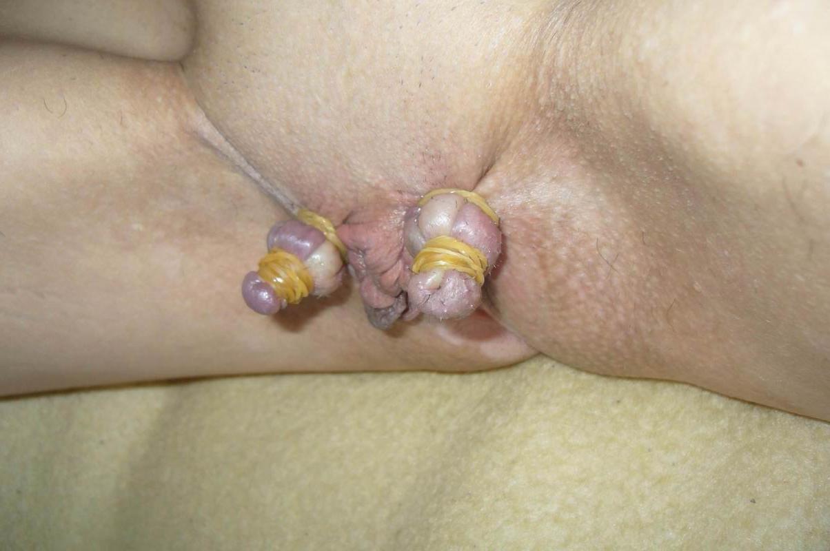 18P Pussy lips extreme bondage