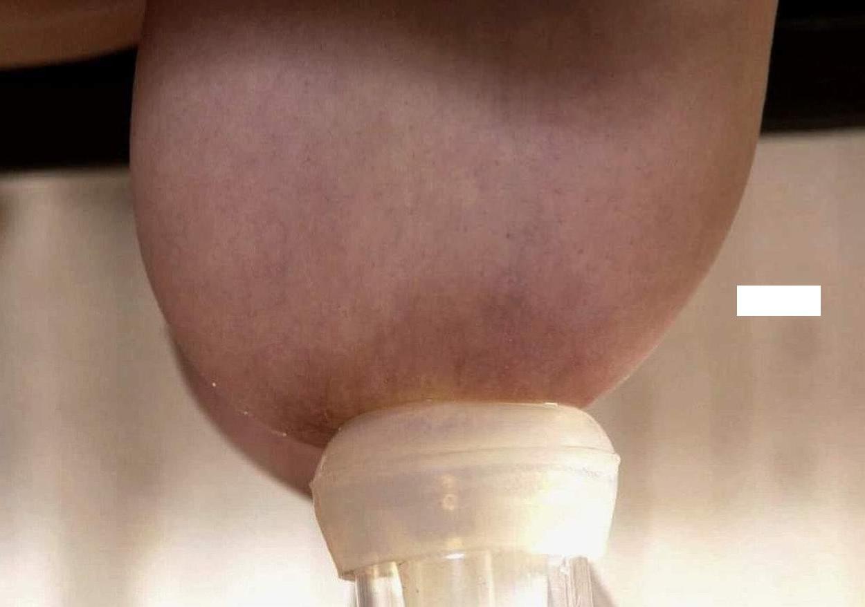 20P lactating babe bondaget and gets milking