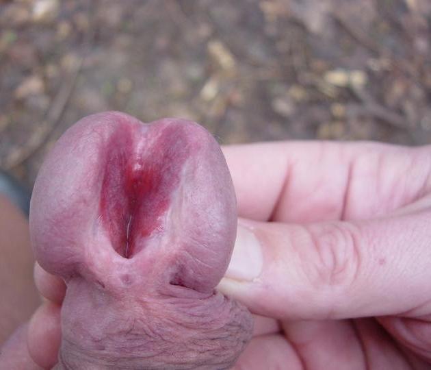 18P very extremely insertions in penis