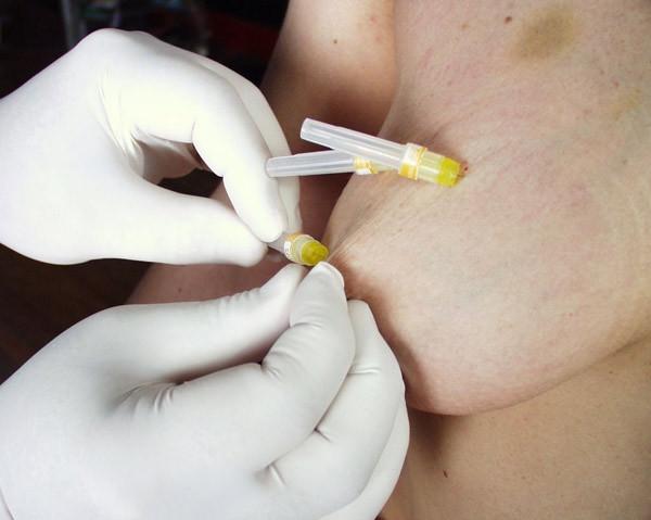 16P Kinky chick gets off on bondage and needle play