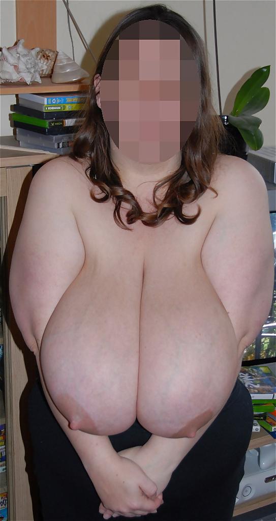 21P BBW's and Cellulite 
