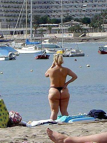 21P BBW's and Cellulite 