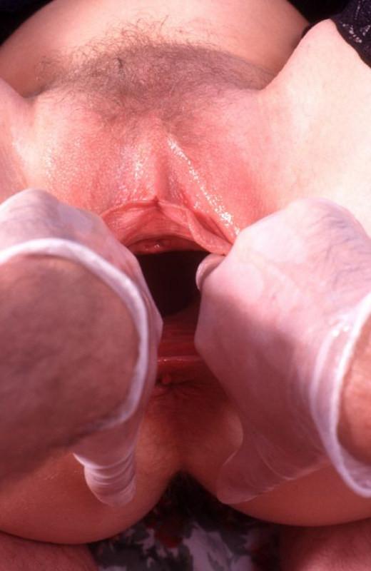 15P extreme pussy stretching