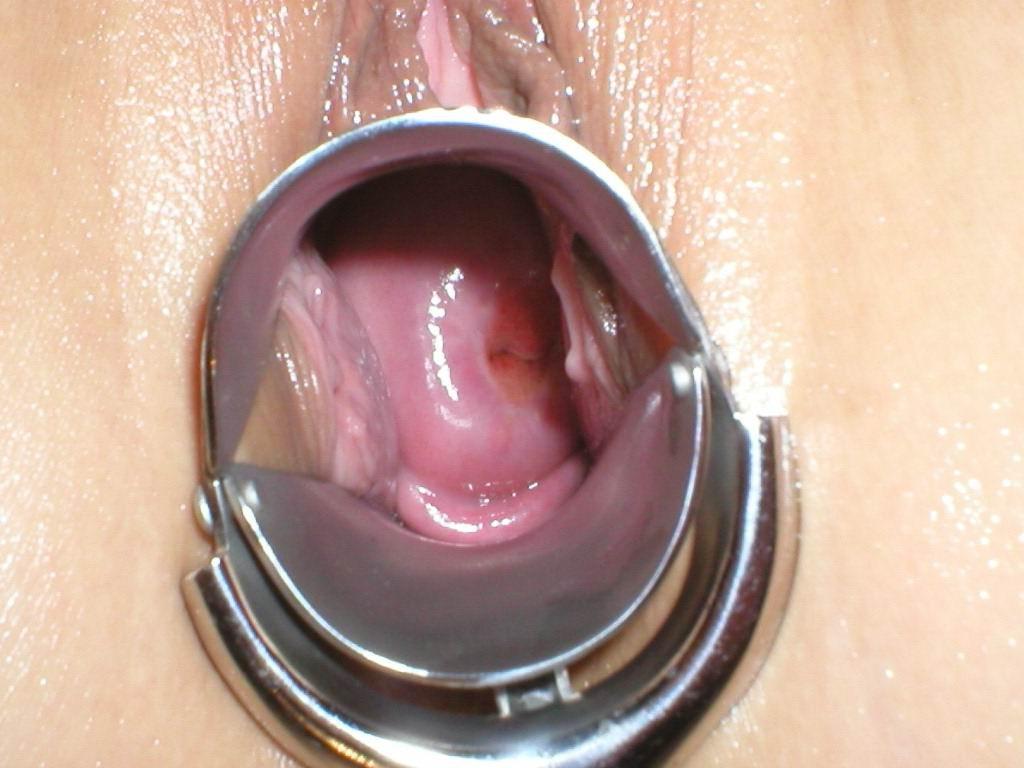 12P swollen female parts fisting and insertions