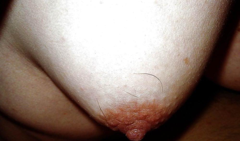 18P hairy boobs nipples and areolas