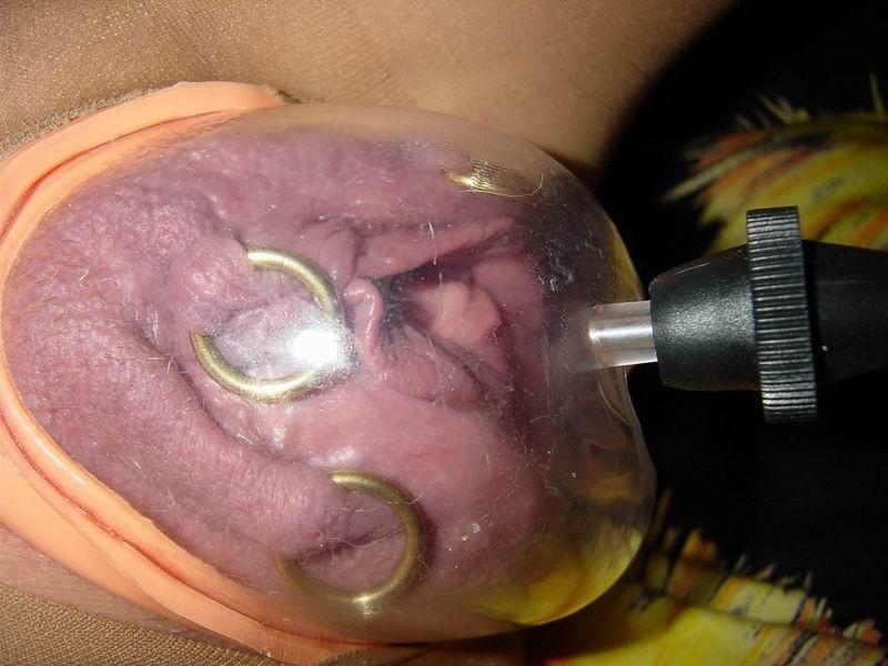 12P Extreme pumping