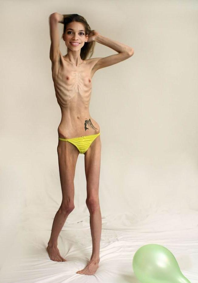 20P Skinny girls