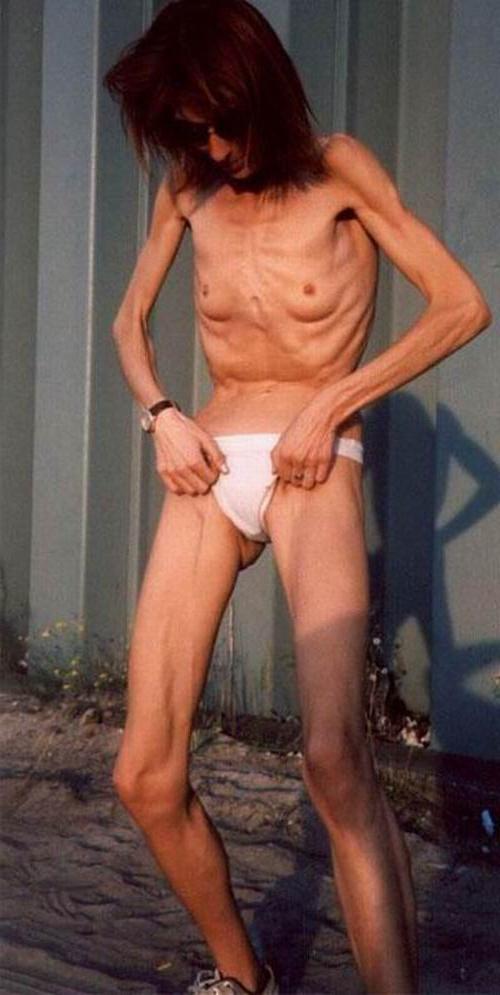 20P Skinny girls