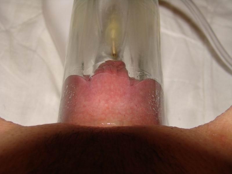 18P etremely pumped pussy
