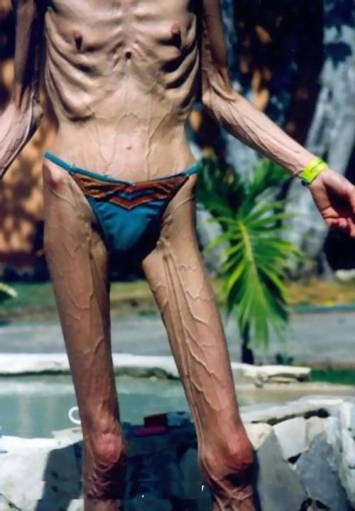 16P very skinny ladies poser