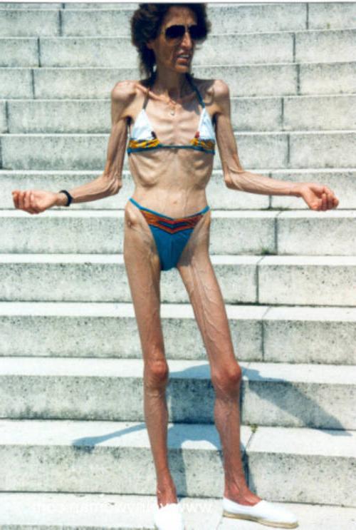 16P very skinny ladies poser
