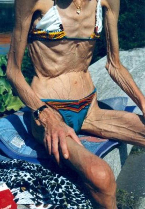 16P very skinny ladies poser