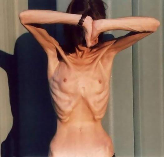 16P very skinny ladies poser