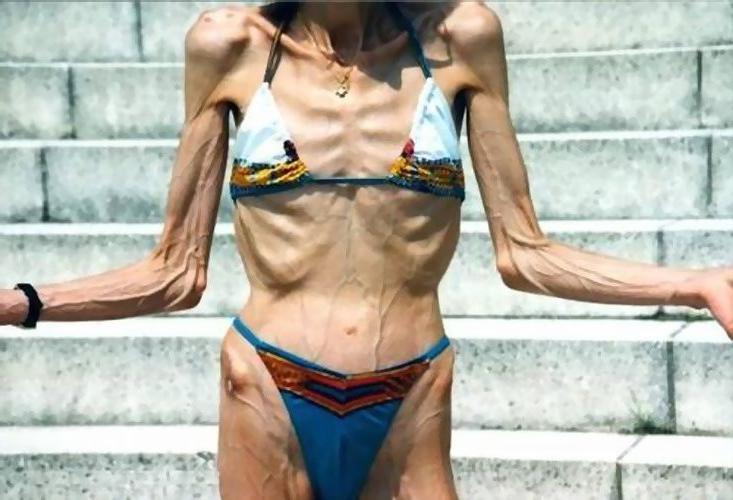 16P very skinny ladies poser