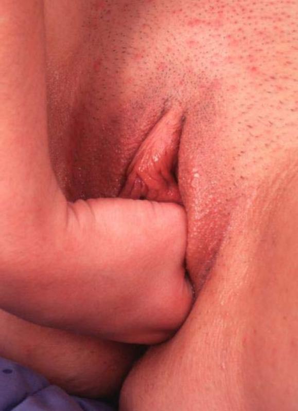 15P Two slut lesbians fisting in bed
