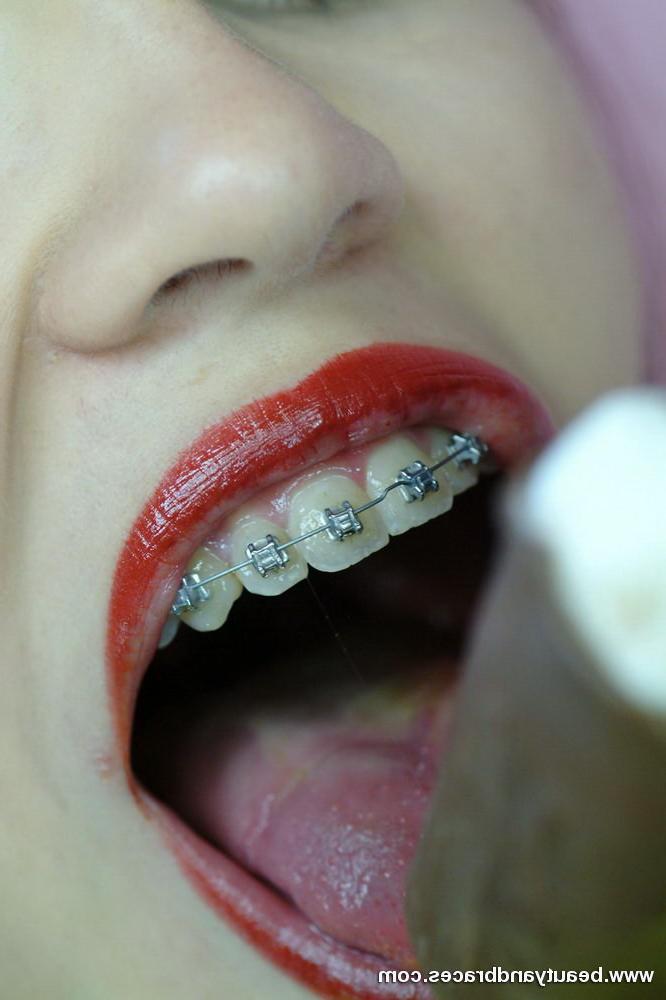 16P Brunette teen with braces gets messy with a popsicle