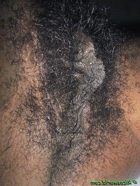 15P Very hairy black girls