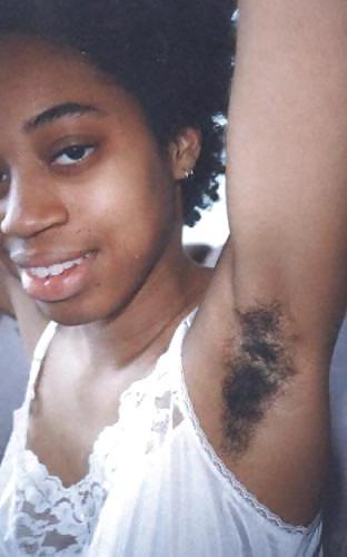 20P Hairy black women 2