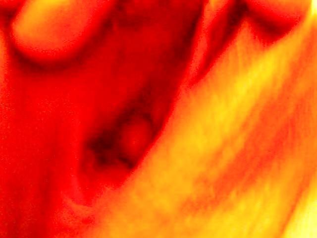 18P Lorenda's fat pudgy BBW pussy shots and tit's.