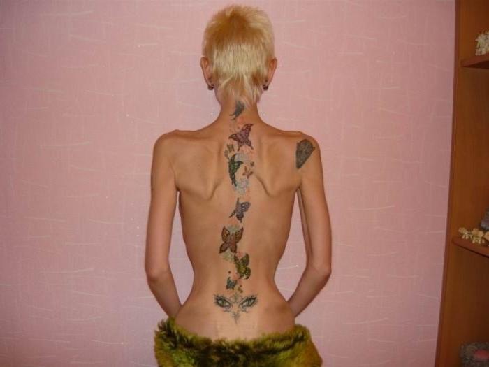 16P skinny anorexic girls showing off their bones