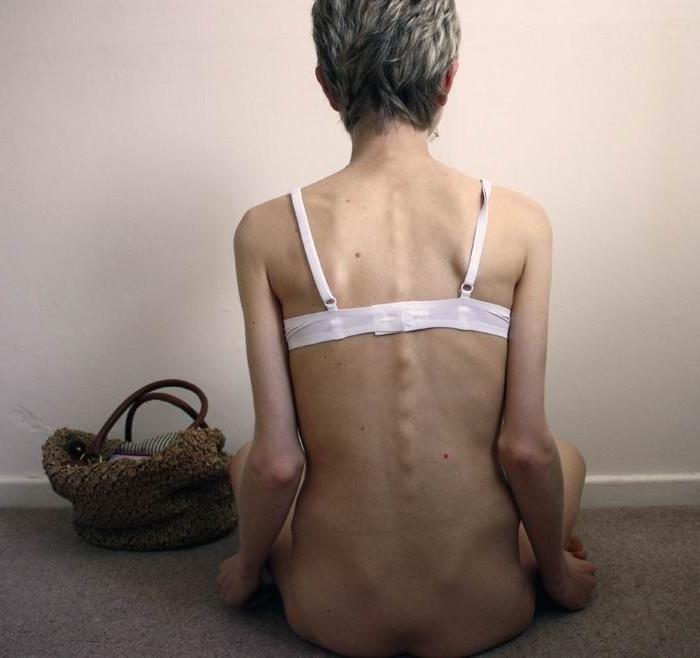 16P skinny anorexic girls showing off their bones