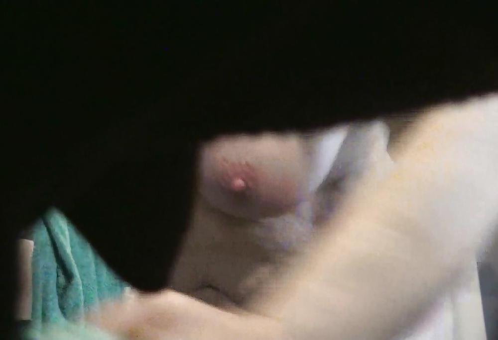 9P Near nipple