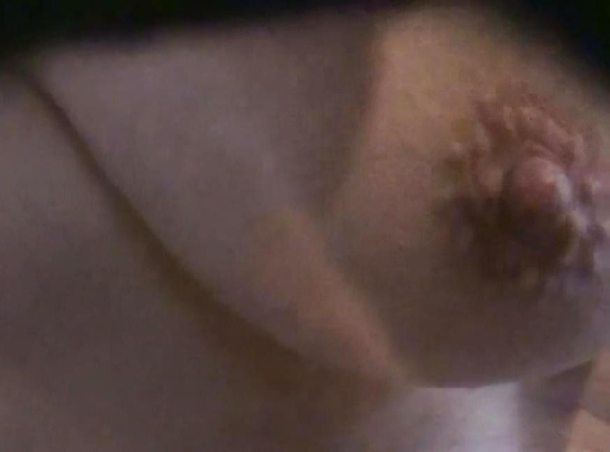 9P Near nipple