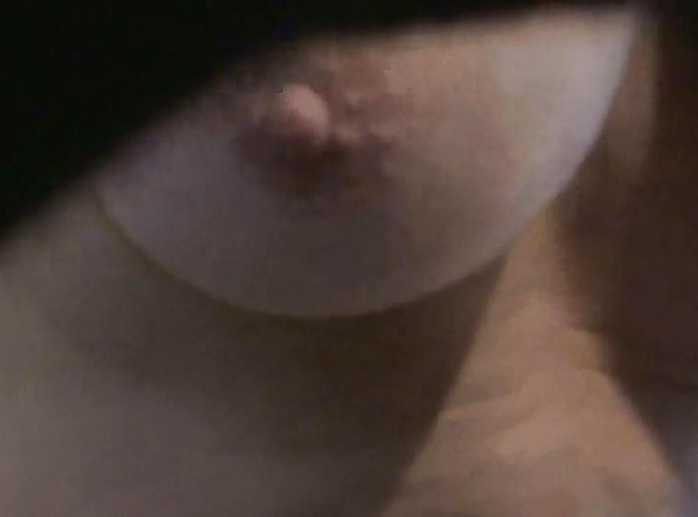 9P Near nipple