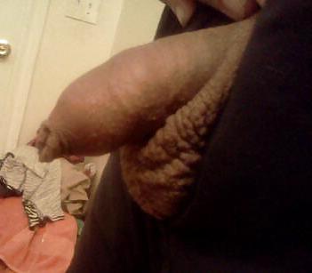 18P My uncut dickl