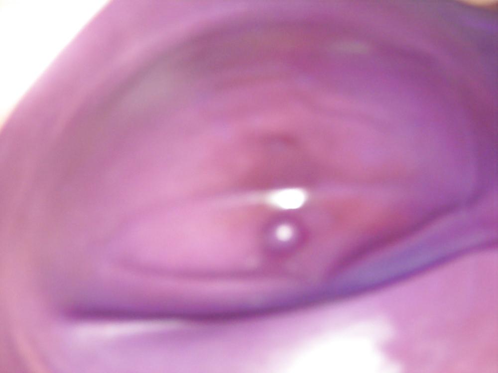 11P BBW in real LATEX 