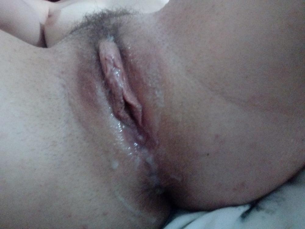 22P Mia.B