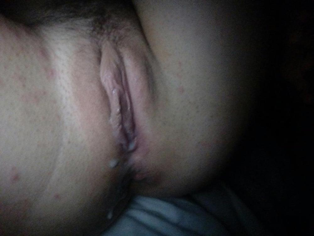 22P Mia.B