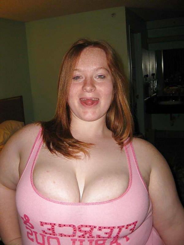 16P Freckle Cleavage