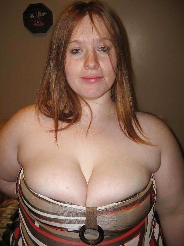 16P Freckle Cleavage