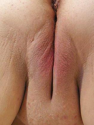 20P Fat BBW twat
