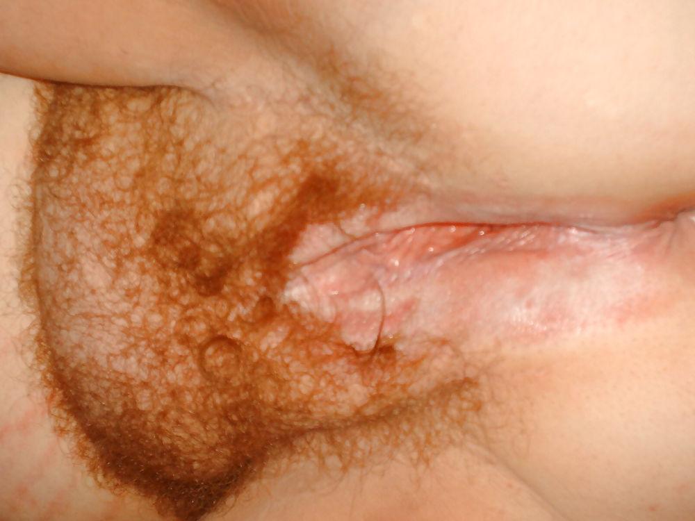 20P Fat BBW twat