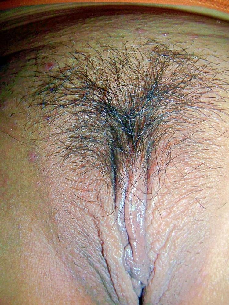 25P Korean Amateur #7