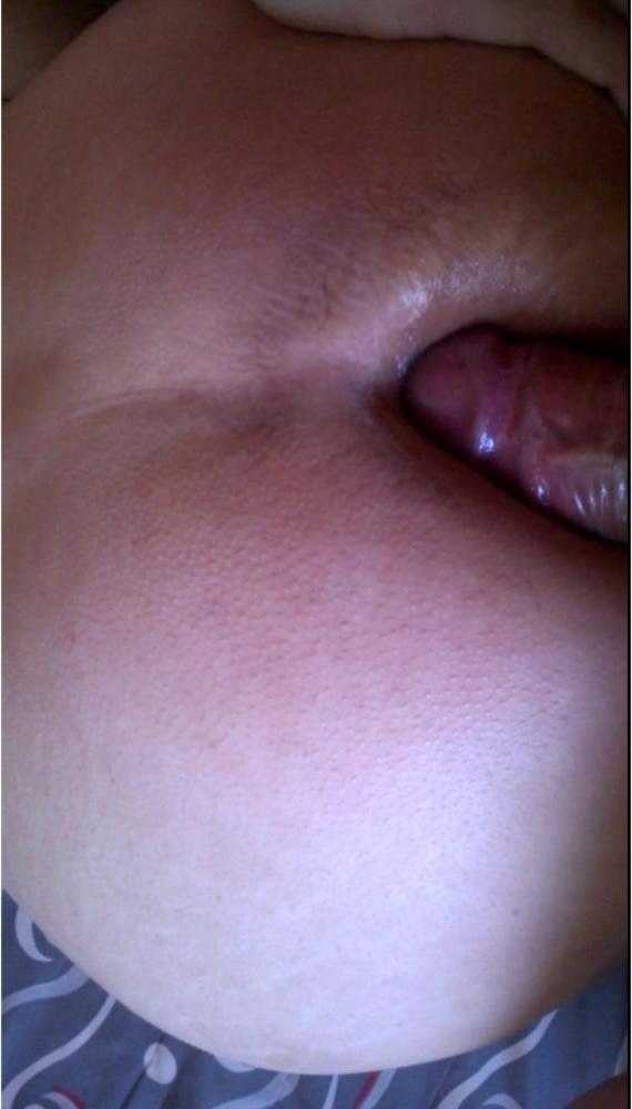 15P First penetration
