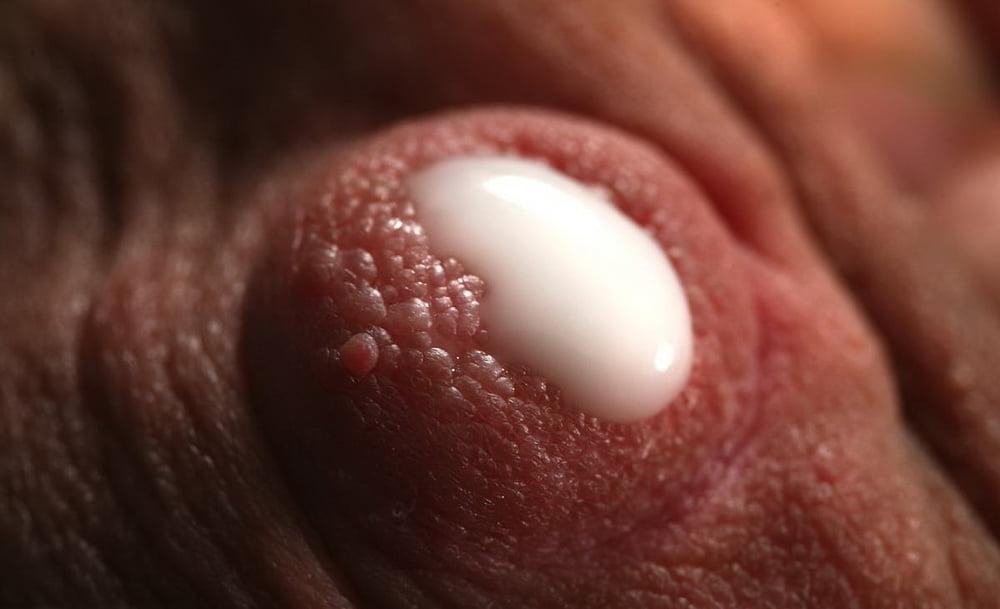 25P LACTATING UDDERS