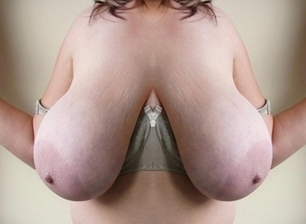 25P LACTATING UDDERS