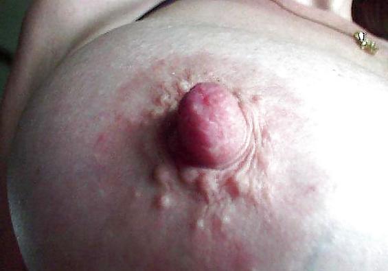 25P Random Nipple Mix