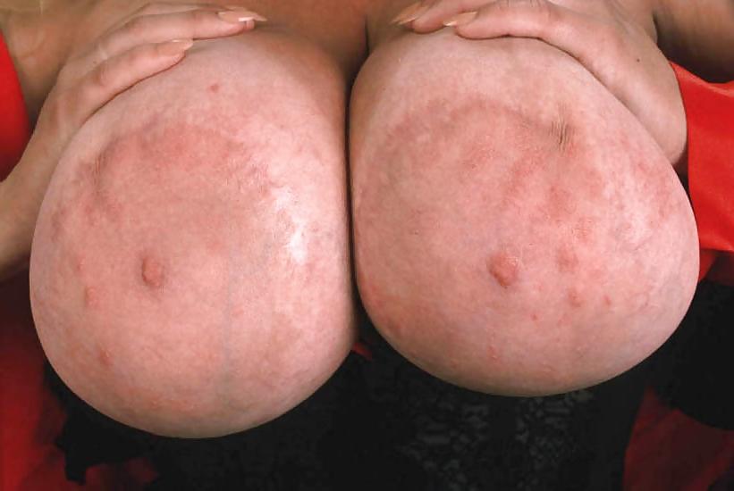 25P Random Nipple Mix