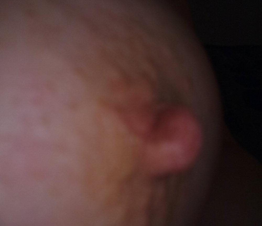 4P Nipple before and after